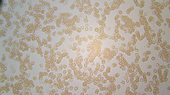 Microscopy: Blood Under Microscope 002