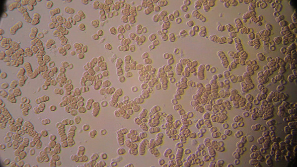 Microscopy: Blood Under Microscope 3
