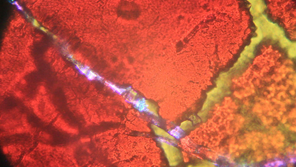 Microscopy Blood Clots Under Microscope 002