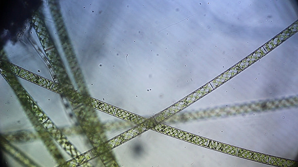 Microscopy: Microscopic Filamentous Algae (Genus Spirogy) 001