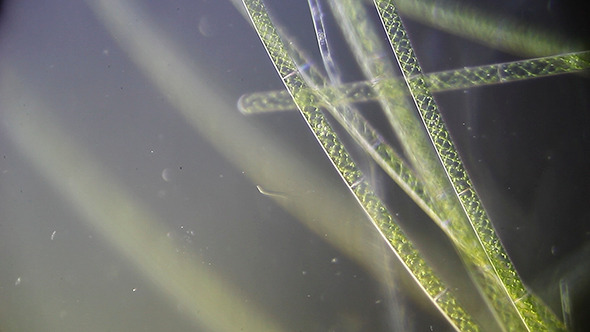 Microscopy: Microscopic Filamentous Algae (Genus Spirogy) 002