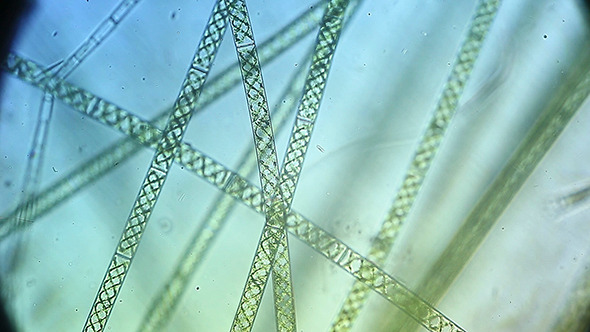 Microscopy: Microscopic Filamentous Algae (Genus Spirogy) 004