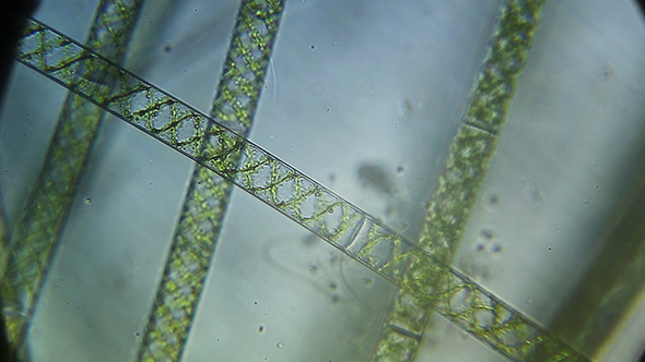 Microscopy: Microscopic Filamentous Algae (Genus Spirogy) 006
