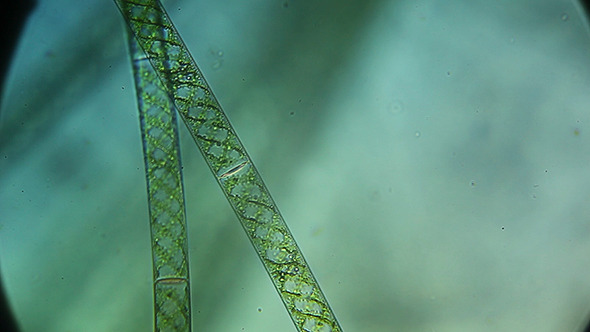 Microscopy: Microscopic Filamentous Algae (Genus Spirogy) 001