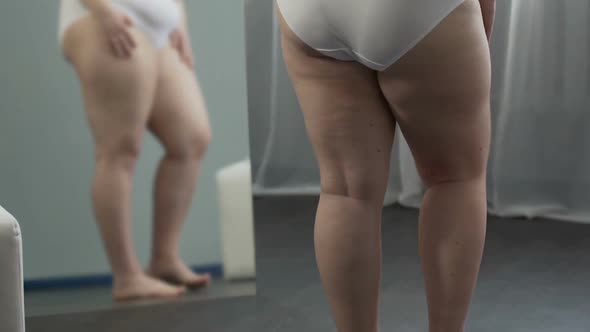 Girl With Weight Problems Looking at Her Legs in Mirror, Touching Them With Hand alt