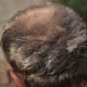 Balding Head - VideoHive Item for Sale