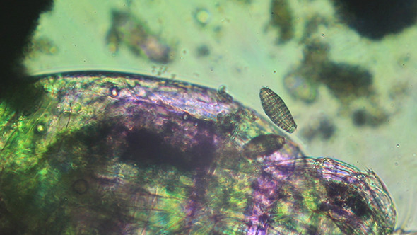 Microscopy: Coleps Ciliate, Microscopy 001