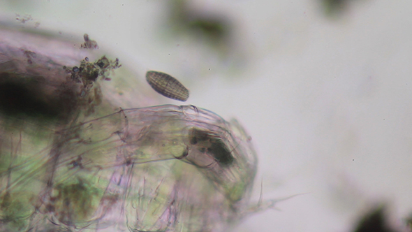 Microscopy: Coleps Ciliate, Microscopy 002