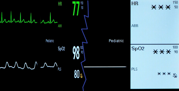 Electrocardiogram - heart monitor