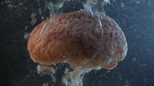 Brain in a Water Tank with Oxygen