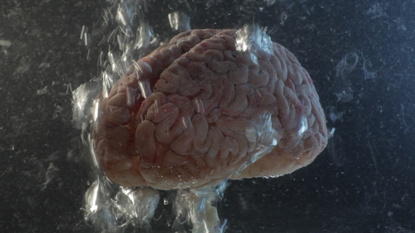 Brain in a Water Tank with Oxygen 02