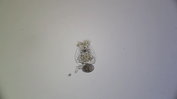 Microscopy: Rotifero Brachionus Plicatilis 001