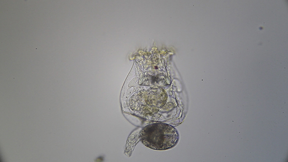 Microscopy: Rotifero Brachionus Plicatilis 002