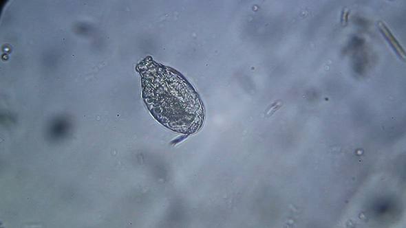 Microscopy: Rotifero Brachionus Plicatilis 004