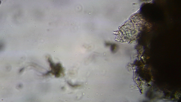 Microscopy: Rotifer Mniobia Magna 1