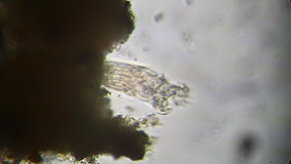 Microscopy: Rotifer Mniobia Magna 002