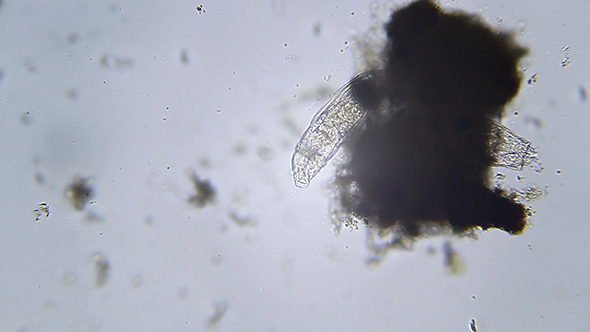 Microscopy: Rotifer Mniobia Magna 003