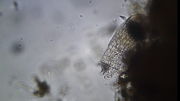 Microscopy: Rotifer Mniobia Magna 4