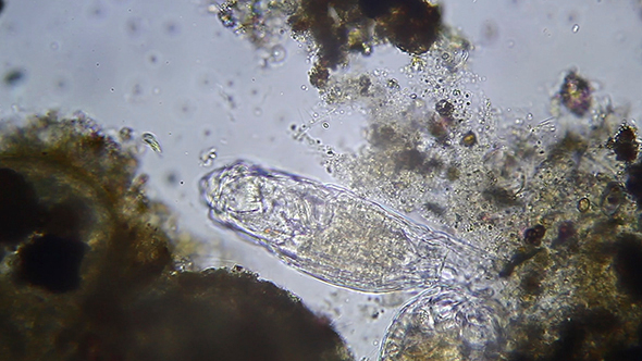 Microscopy: Rotifer Mniobia Magna 006