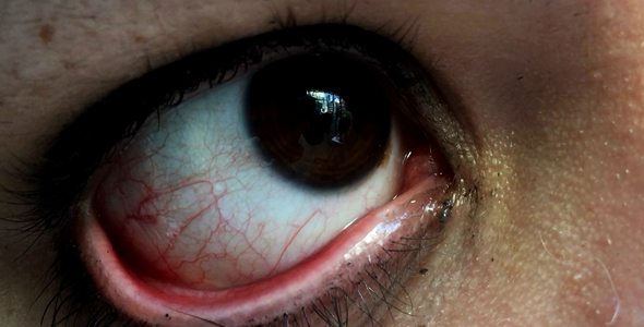 Young Girl Eyes Detail alt