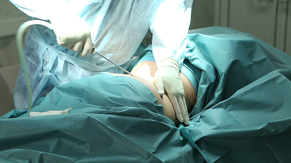 Surgeon Hands During Liposuction