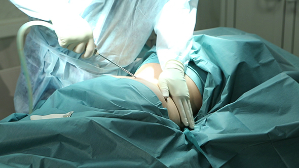 Surgeon Hands During Liposuction alt