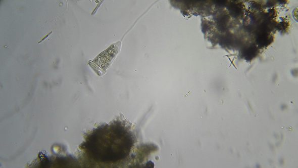 Microscopy: Vorticella sp (Unidentified Species) 001