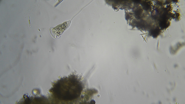 Microscopy: Vorticella sp (Unidentified Species) 002