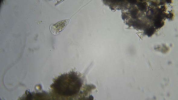 Microscopy: Vorticella sp (Unidentified Species) 003