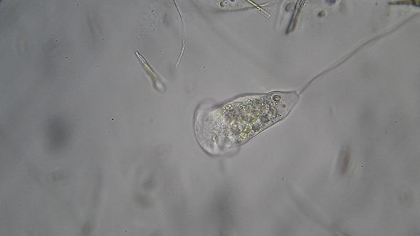 Microscopy: Vorticella sp (Unidentified Species) 004