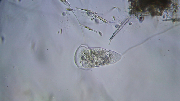 Microscopy: Vorticella sp (Unidentified Species) 005
