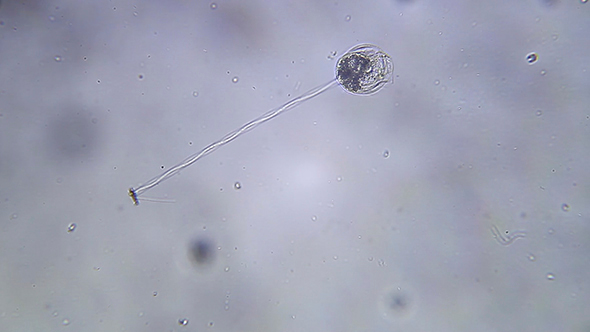 Microscopy: Vorticella sp (Unidentified Species) 006