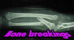 Bone breakings
