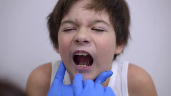 Closeup Face of Ill Caucasian Boy Opening Mouth As Unrecognizable Doctor Checking Oral Cavity with alt