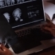 Doctor Looking At X-ray Of The Evening At a Laptop - VideoHive Item for Sale