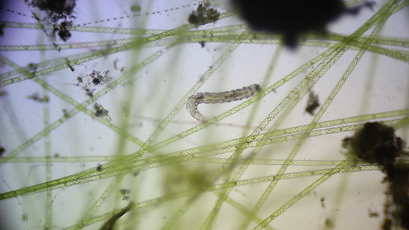 Microscopy: Microscopic Filamentous Algae and Mosquito Larvae 1