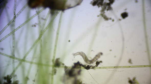 Microscopy: Microscopic Filamentous Algae and Mosquito Larvae 2