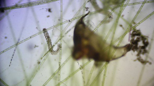Microscopy: Microscopic Filamentous Algae and Mosquito Larvae 3