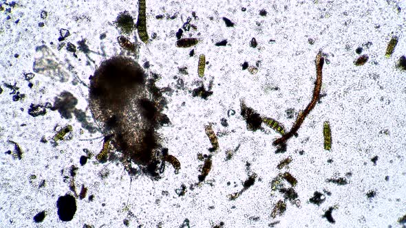 çThe Body of a Dead Mite Is Eaten By Many Scavenger Bacteria, Stock Footage