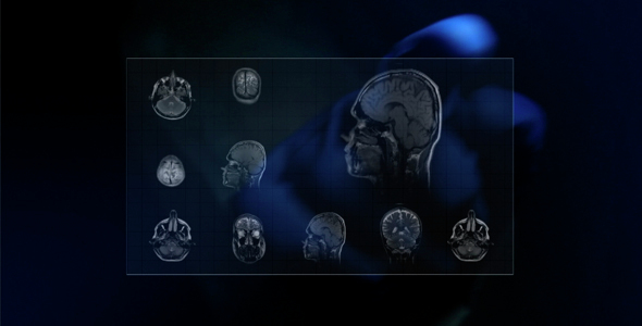 Magnetic Resonance Imaging alt