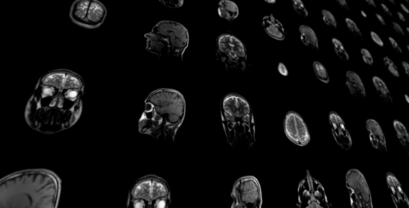 Magnetic Resonance Imaging alt