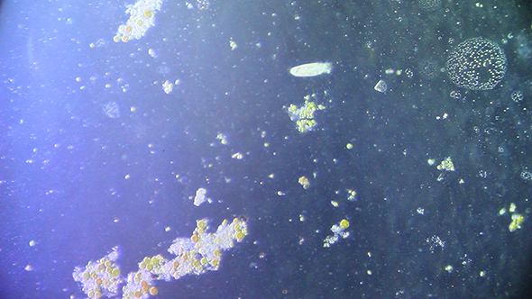 Microscopy: Cultivation. Different Bacterial Colonies 3