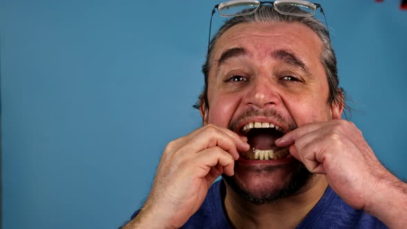 Man's Hand Putting Dental Crowns in Teeth alt