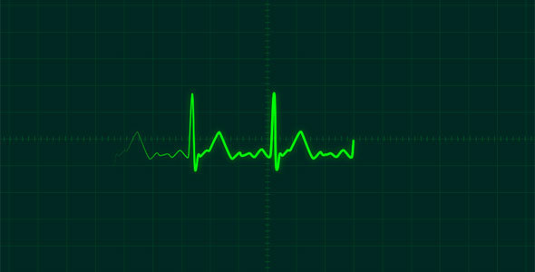 Real EKG Diagram Pack