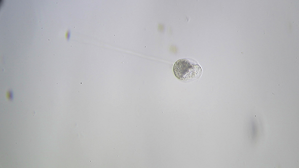 Microscopy: Protozoa Vorticella Microscopy 1