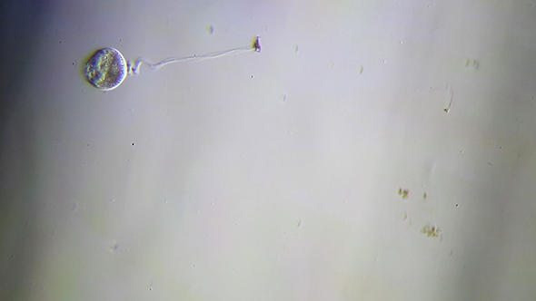 Microscopy: Protozoa Vorticella Microscopy 2