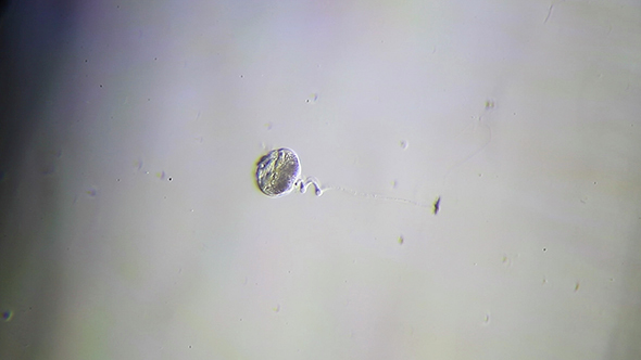 Microscopy: Protozoa Vorticella Microscopy 3