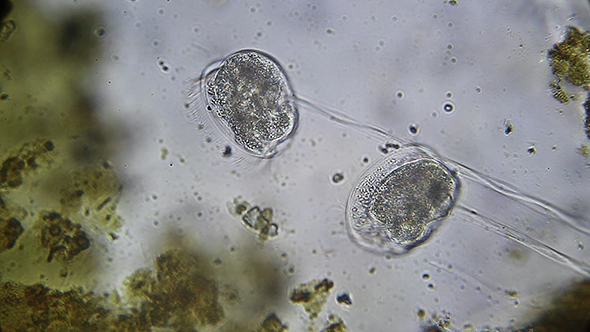 Microscopy: Protozoa Vorticella Microscopy 4