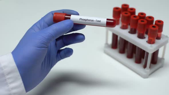 Phosphorus Test, Doctor Showing Blood Sample In Tube, Lab Research ...