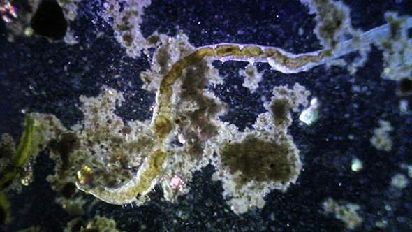 Microscopy: Parasite Worm 1
